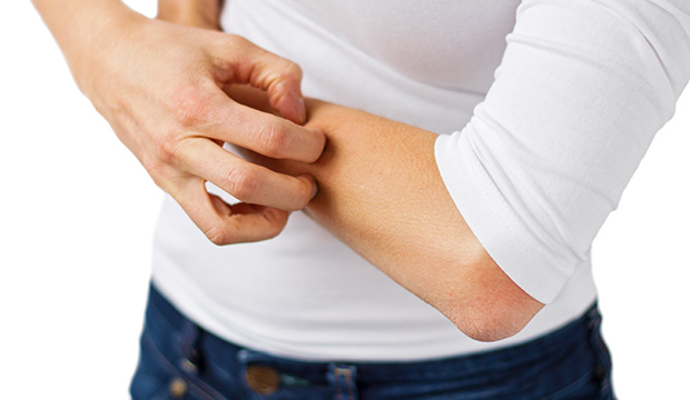 Atopická dermatitída – svrbivé fakty